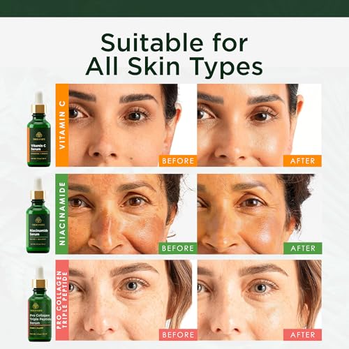 Image 3 of Tree of Life Face Serum Skin Care Set, Vit C, Niacinamide & Peptides Serum