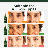 Thumbnail for Image 3 of Tree of Life Face Serum Skin Care Set, Vit C, Niacinamide & Peptides Serum