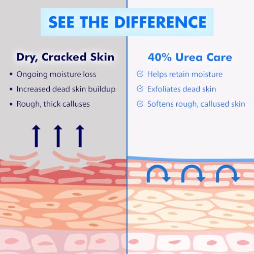 Image 9 of Ebanel Urea Cream 40% plus Salicylic Acid for Dry Cracked Feet Skin