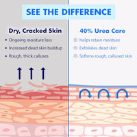 Thumbnail for Image 9 of Ebanel Urea Cream 40% plus Salicylic Acid for Dry Cracked Feet Skin