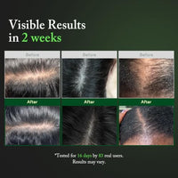 Thumbnail for Image 4 of AROMATICA Overnight Rosemary PDRN Scalp Serum for Scalp Treatment