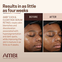 Thumbnail for Image 5 of Ambi Even & Clear Fade Serum, 1 Fl Oz