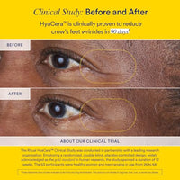 Thumbnail for Image 5 of Ritual Hyaluronic Acid Skin Supplement - HyaCera Skin Hydration Support