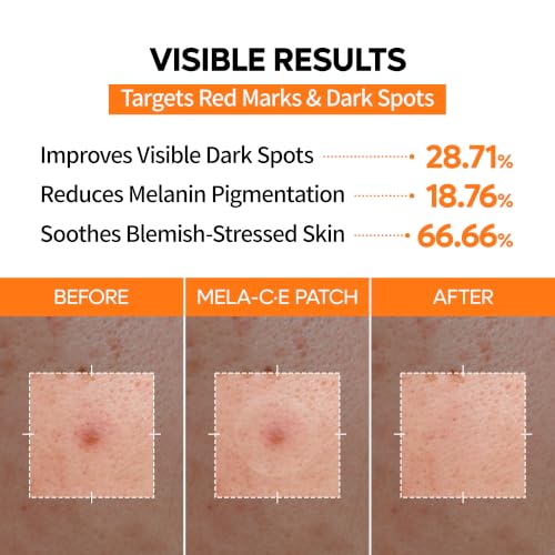 Image 4 of Dr.Melaxin Mela-C·E ZERO-FIT Invisible Ultra Thin Pimple Patches for Face, 72 Count