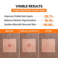 Thumbnail for Image 4 of Dr.Melaxin Mela-C·E ZERO-FIT Ultra Thin Spot Patch 12mm x 72 Patches (Pack of 2)
