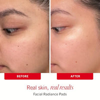 Thumbnail for Image 7 of First Aid Beauty Sensitive Skin Skincare Routine Set, 3-Piece