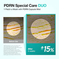 Thumbnail for Image 5 of ANUA PDRN Collagen Melting Patch for Neck, 0.02g x 4ea