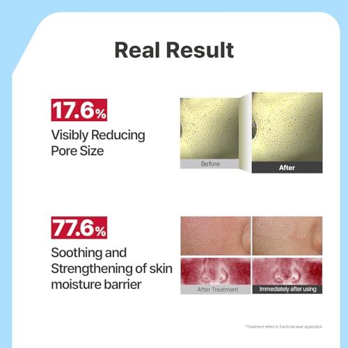 Image 5 of Illiyoon Ceramide Ato Concentrate Gel Face Mask 34g x 4ea