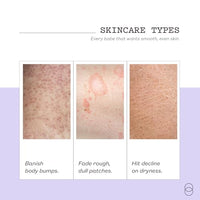 Thumbnail for Image 6 of frank body Niacinamide Body Scrub 250g/8.82 oz