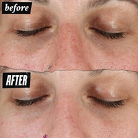 Thumbnail for Image 8 of Kiehl's Clearly Corrective Dark Spot Solution Brightening Serum