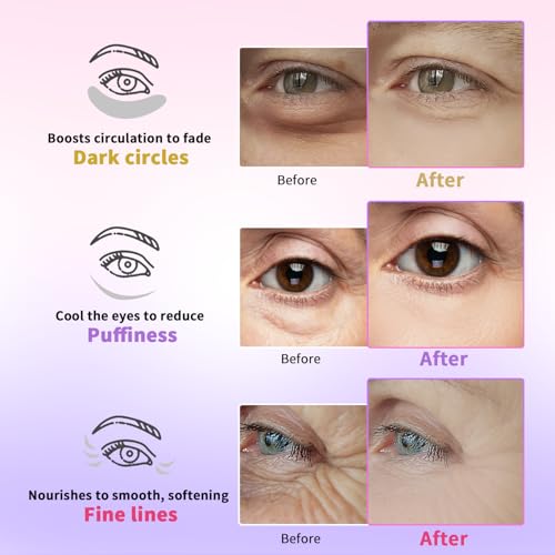 Image 4 of AILEORY Under Eye Patches for Dark Circles, Puffiness, Fine Lines, Eye Mask Set with Retinol, 24K Gold, Caffeine, Gel Mask, 24 Pairs