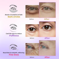 Thumbnail for Image 4 of AILEORY Under Eye Patches for Dark Circles, Puffiness, Fine Lines, Eye Mask Set with Retinol, 24K Gold, Caffeine, Gel Mask, 24 Pairs