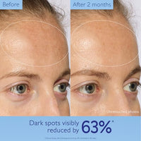 Thumbnail for Image 3 of Caudalie Vinoperfect Brightening Dark Spot Serum Vitamin C Alternative