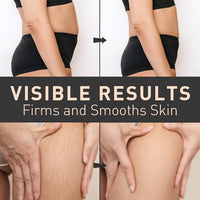Thumbnail for Image 6 of Enaskin Naturals Belly Firming Cream 100 mL