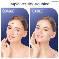 Thumbnail for https://shopify-staged-uploads.storage.googleapis.com/tmp/97228161387/files/b53eba35-43d8-40b6-a008-4f9d6becaadb/297bf9716b951503a5845bfca9a468e5f4b374c6.img