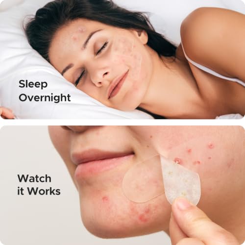 Image 7 of TKTK Large Pimple Patches for Face & Body