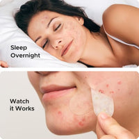Thumbnail for Image 7 of TKTK Large Pimple Patches for Face & Body
