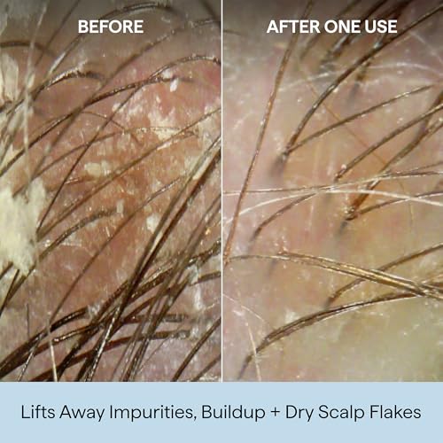 Image 10 of Briogeo Scalp Revival Charcoal + Coconut Oil Micro-Exfoliating Shampoo