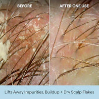 Thumbnail for Image 10 of Briogeo Scalp Revival Charcoal + Coconut Oil Micro-Exfoliating Shampoo