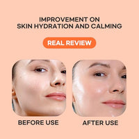 Thumbnail for Image 3 of Epielle Vitamin C Serum Sheet Masks (5pk)