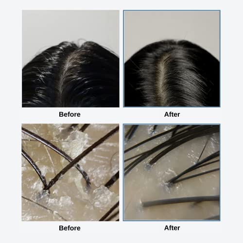 Image 7 of GROWUS Sea Salt Therapy Scalp Care Duo (250g)