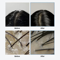Thumbnail for Image 7 of GROWUS Sea Salt Therapy Scalp Care Duo (250g)