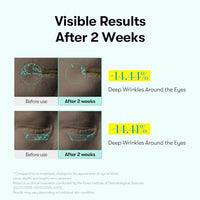 Thumbnail for Image 3 of VT COSMETICS PDRN Reedle Shot Eye Cream, 0.51 fl oz