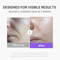 Thumbnail for Image 4 of medicube Booster Pro Mini Plus - Portable Facial Device for Radiance, Beige