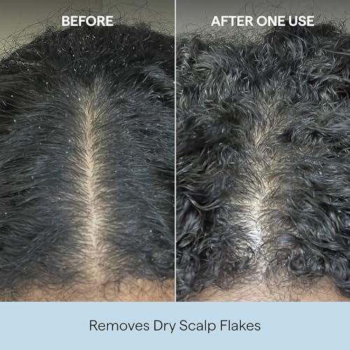 Image 8 of Briogeo Scalp Revival Charcoal + Coconut Oil Micro-Exfoliating Shampoo