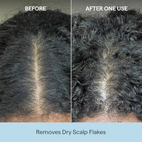 Thumbnail for Image 8 of Briogeo Scalp Revival Charcoal + Coconut Oil Micro-Exfoliating Shampoo