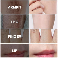 Thumbnail for Image 5 of PHOFAY Hair Removal Cream for Women & Men Smooth Hair Removal Spray