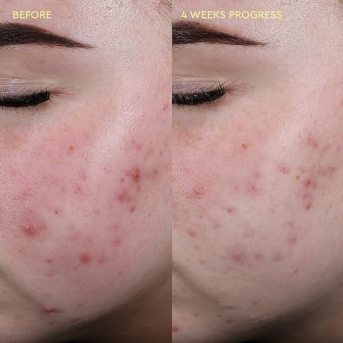 Image 2 of BYOMA Blemish Redness Relief Soothing Toner for Acne-Prone Skin (100ml)