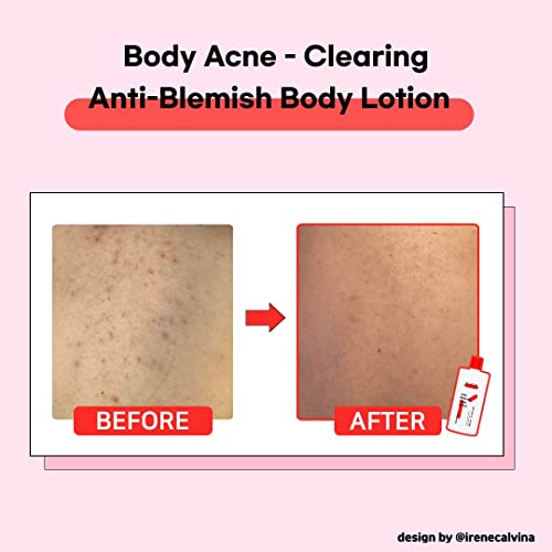 Image 3 of TIAM Anti-Blemish Body Lotion, 6.76 fl oz