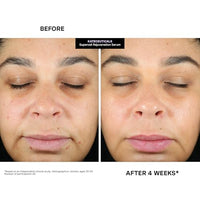 Thumbnail for Kate Somerville KateCeuticals® SuperCell Rejuvenation Peptide Serum
