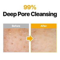 Thumbnail for MANYO Pure Cleansing Oil, Natural Oil Cleanser for Face, Makeup Blackhead Remover, Korean Skin Care, 6.76 fl oz (200ml)