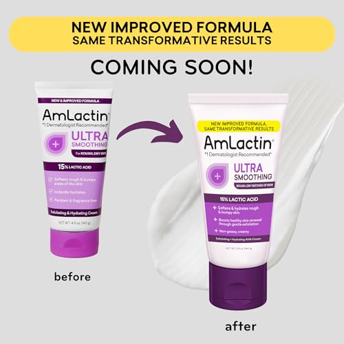 AmLactin Ultra Smoothing - Therapeutic Hand Cream for Dry Cracked Hands - No-Scrub Exfoliator and Moisturizer with 15% Lactic Acid AHA, 4.9 oz (Packaging May Vary)