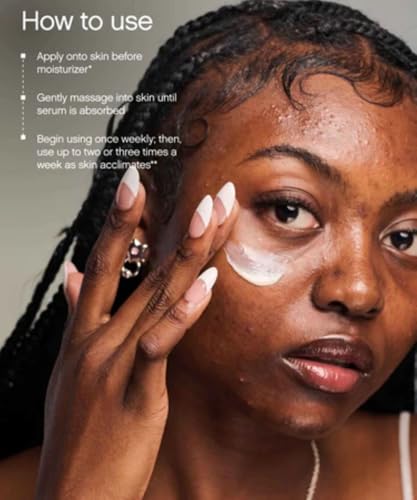 Topicals Faded Brightening and Clearing Serum | Reduces Discoloration, Post-Blemish Marks, Scars and Spots | Contains Kojic Acid and Niacinamide | Dermatologist-tested, Vegan, Cruelty-Free (1.7 Fl Oz)