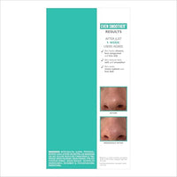 Thumbnail for Peter Thomas Roth | Even Smoother™ Microdermabrasion Exfoliating Pore Purifier with Salicylic Acid for Oil Control
