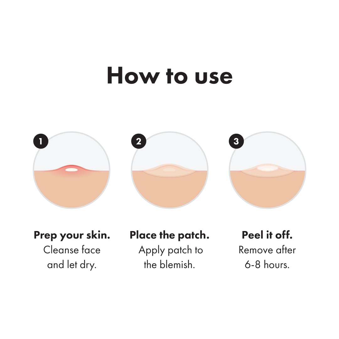 Mighty Patch™ Invisible+ Patch – The Barely-There Daytime Hydrocolloid Acne Pimple Patch for Covering Zits and Blemishes, Tapered Edges Designed to Blend Into Skin (72ct)