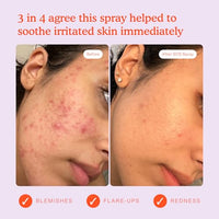 Thumbnail for Tower 28 SOS Daily Rescue Facial Spray for Sensitive Skin, Hypochlorous Acid Spray Helps Reduce Redness and Breakouts, Travel Size Toner for Face, 1 FL Oz