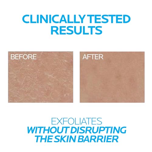 La Roche-Posay Lipikar Urea 10% Roughness Smoothing Lotion, Body Lotion For Dry Skin With 10% Urea + Shea Butter + Allantoin, Rough And Bumpy Skin Lotion, Softens & Smooths Skin With 1 Application