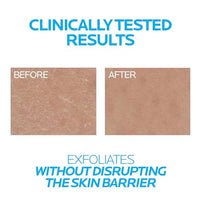 Thumbnail for La Roche-Posay Lipikar Urea 10% Roughness Smoothing Lotion, Body Lotion For Dry Skin With 10% Urea + Shea Butter + Allantoin, Rough And Bumpy Skin Lotion, Softens & Smooths Skin With 1 Application