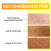 Thumbnail for numbuzin No.5 Toner | Vitamin Boosting Essential Toner | First Step Skin Care | Improves Hyperpigmentation and Uneven Skin Tone | 6.76 fl. oz.