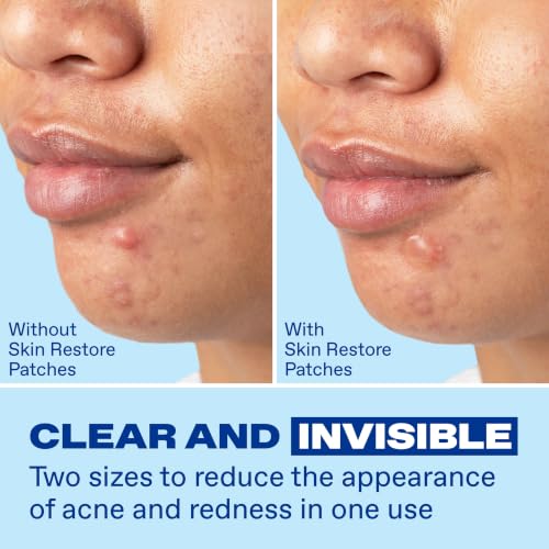 Image 5 of Differin Power Pimple Patches, Hydrocolloid Acne Treatment, 23ct