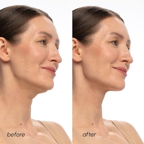 Image 4 of MAREE PDRN Salmon DNA Chin Lifting Mask 5 Ct