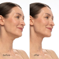 Thumbnail for Image 4 of MAREE PDRN Salmon DNA Chin Lifting Mask 5 Ct