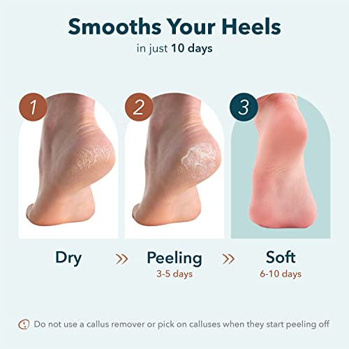 Image 7 of Purederm Exfoliating Foot Mask