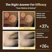 Thumbnail for Image 6 of Dr.Reju-All Advanced Retino-Mela Serum + Advanced LC-Ceramide Barrier Cream