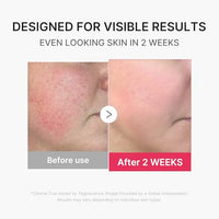 Thumbnail for Image 5 of medicube Mini Booster Pro Plus - Portable Facial Device for Radiance, Pink