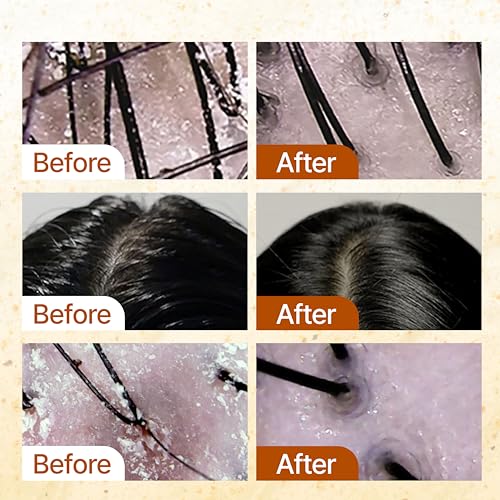 Image 5 of GROWUS Sea Salt Clarifying Shampoo | Exfoliating Scalp Scrub for Oily Hair
